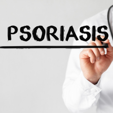 Psoriasis is the result of your body's immune system.