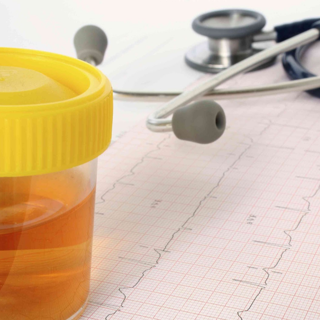 How Dangerous Is Seeing Blood in Urine?