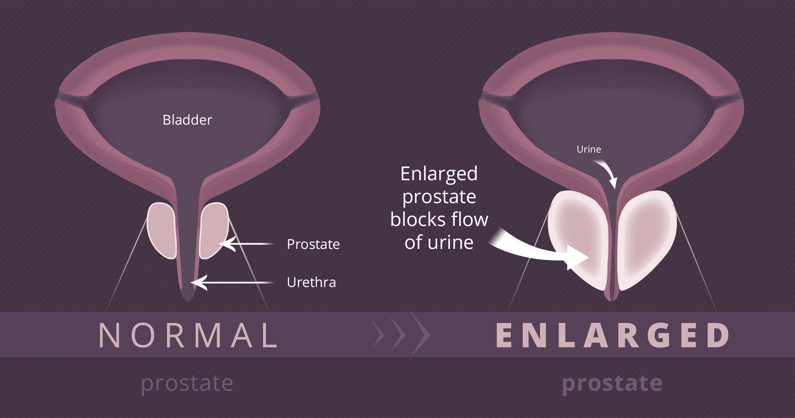 pezeshkbook.com - Prostate