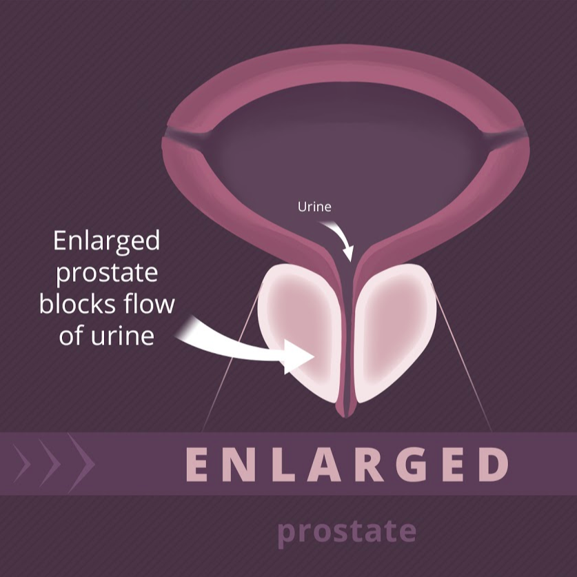 Learn More About the Prostate!