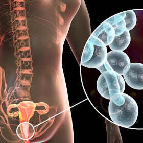 What Can We Do to Prevent a Vaginal Infection?