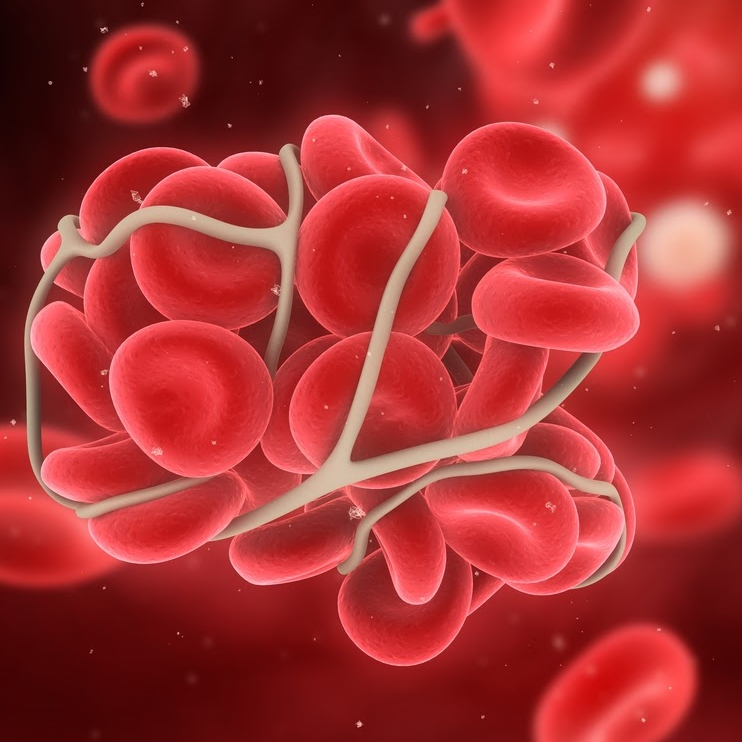 What is Blood Clotting Disorder and Why Does it Happen?