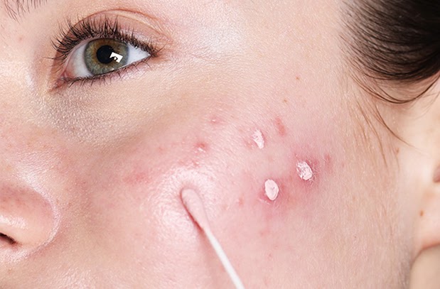 Why Skin Gets Damaged